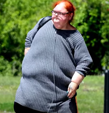 Shocking footage of 1000-Lb Sisters star Tammy Slaton’s skin surgery